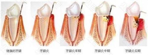 鄂尔多斯市东胜区张辉口腔诊所擅长项目