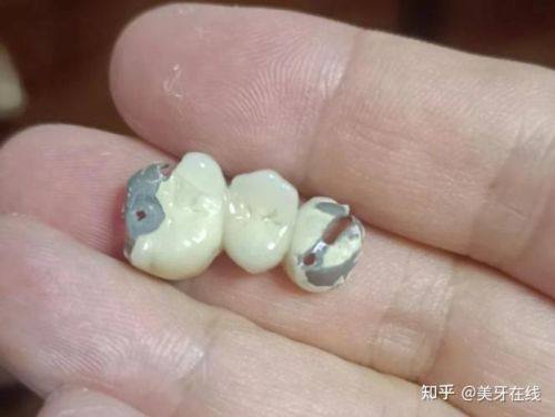 重庆博莱口腔价格表：