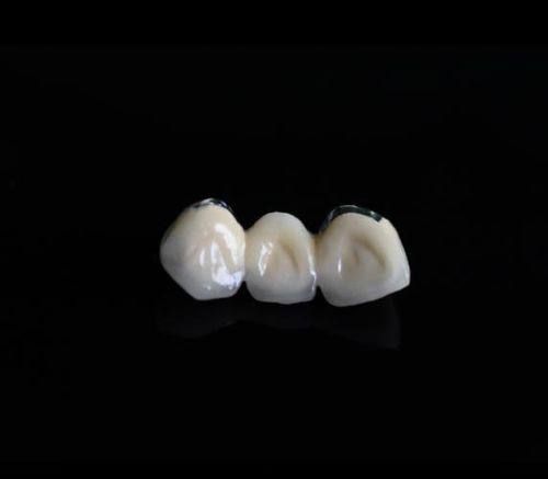 重庆博莱口腔口碑评价：