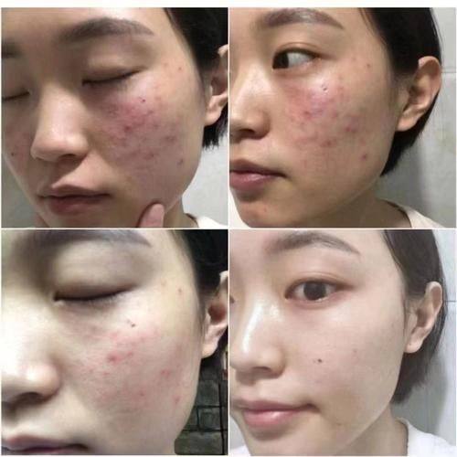 任丘艾薇依医疗美容诊所擅长项目：