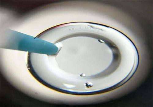承德市中医院眼科预约挂号方式：