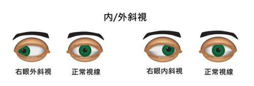 承德市中医院眼科怎么样？