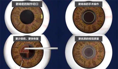 佛山市口腔医院眼科预约挂号方式: