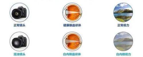 佛山市口腔医院眼科医生名单及擅长领域: