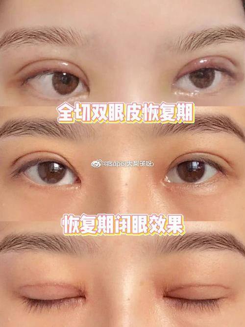 厦门华美名媛整形美容医院预约挂号方式: