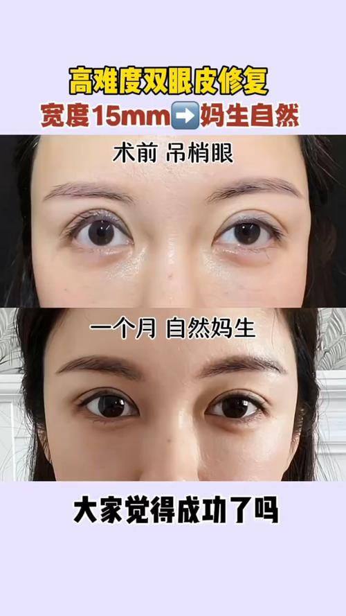 西安时光整形美容医院口碑评价: