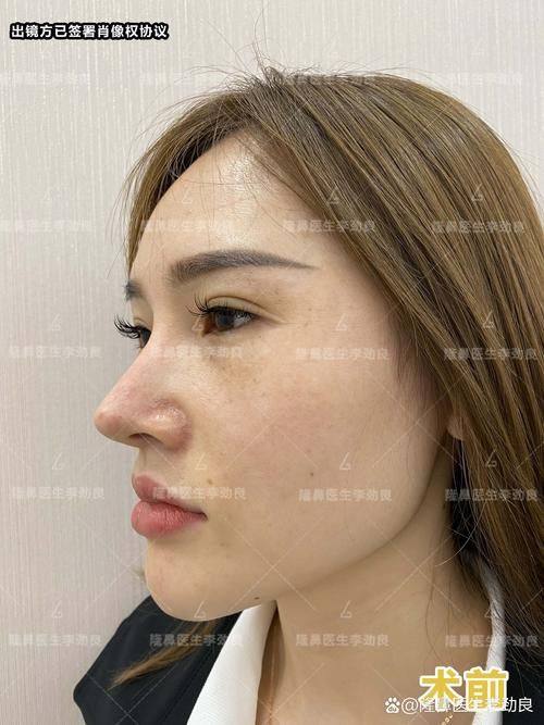 贵州省妇幼保健院(医学美容科)价格表：