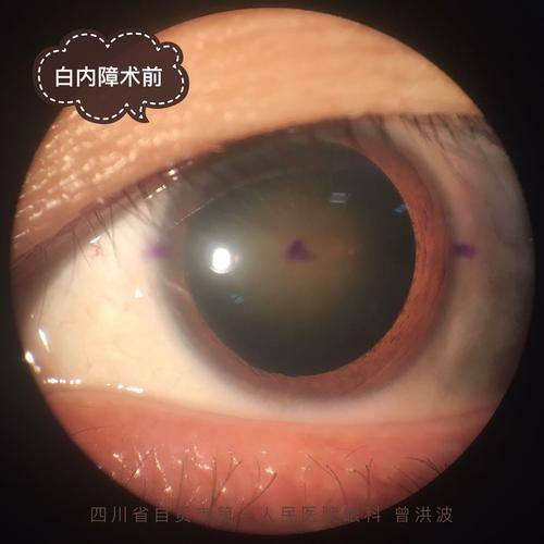 佛山市口腔医院眼科地址电话及营业时间: