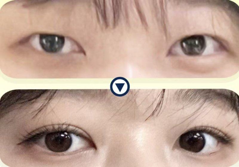 史桂凡医生怎么预约